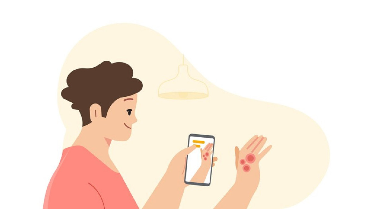 У Google розробили технологію, яка допомагає людям визначати шкірні захворювання - фото 1