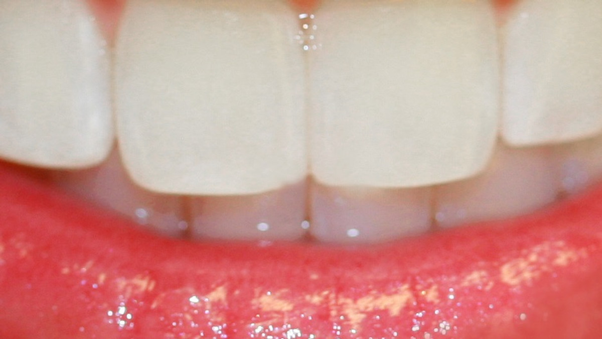Оральний секс і пірсинг у роті погіршують стан зубів - фото 1