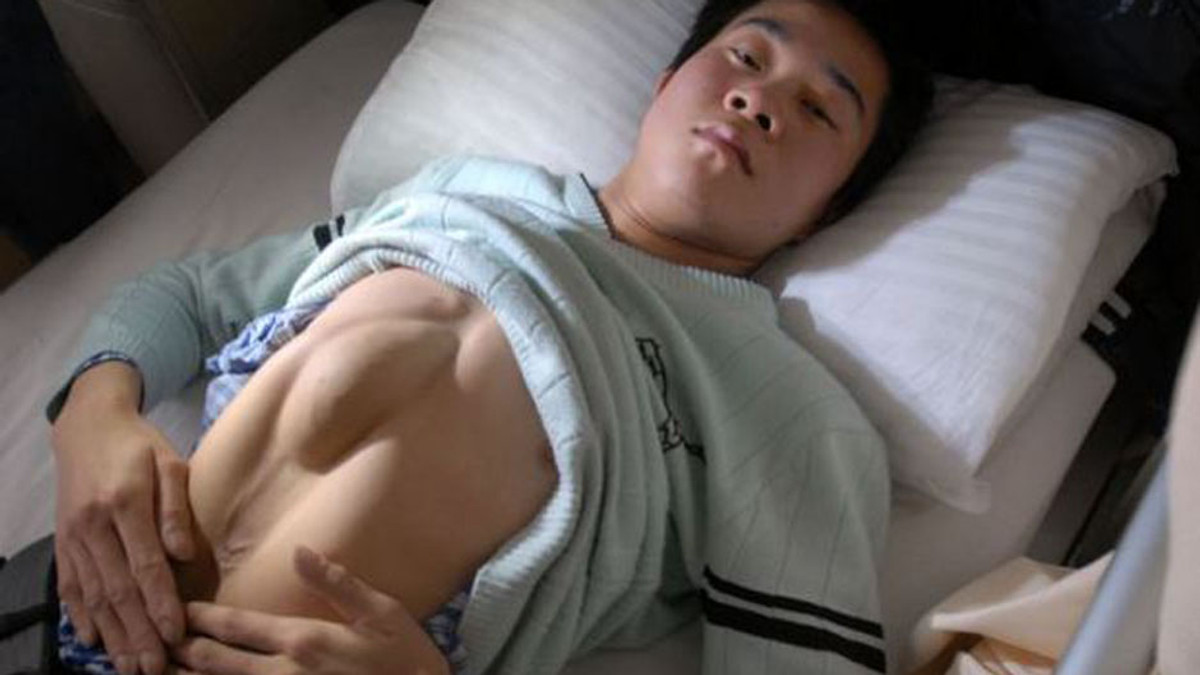 Китаєць 24 роки жив із серцем у шлунку - фото 1