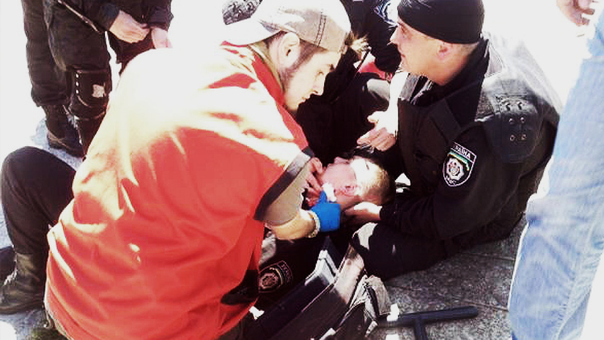 В одного з поранених на Марші рівності міліціонерів перебита артерія - фото 1