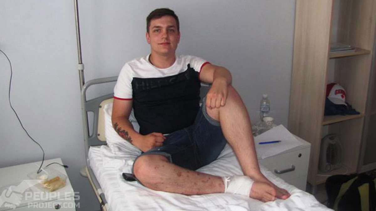 Українські лікарі відновили ногу 19-річному добровольцю - фото 1