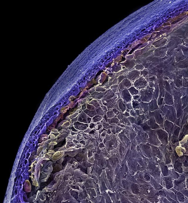 Як виглядає їжа під мікроскопом: вражаючі кадри - фото 320059