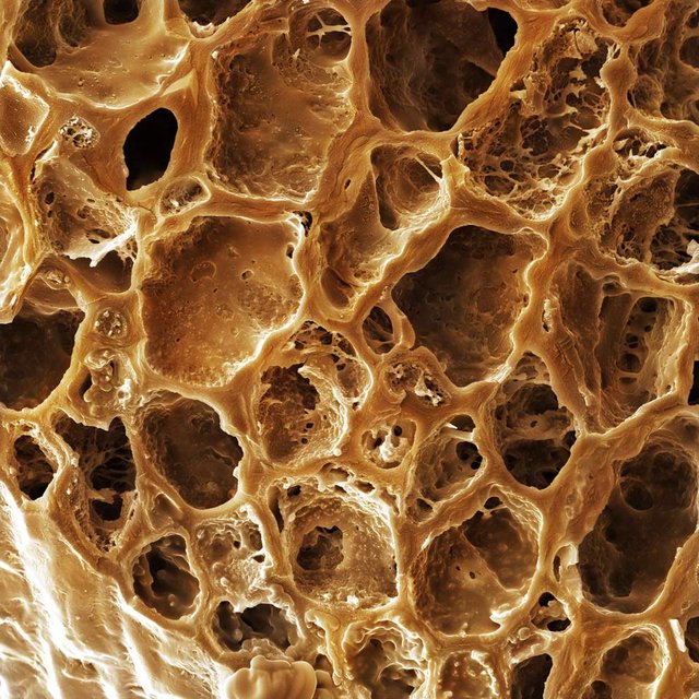Як виглядає їжа під мікроскопом: вражаючі кадри - фото 320061