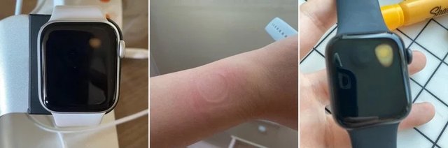 Власники Apple Watch SE скаржаться на перегрів годинників і проблеми з екраном - 431302 Власники Apple Watch SE скаржаться на перегрів годинників і проблеми з екраном - фото 431302