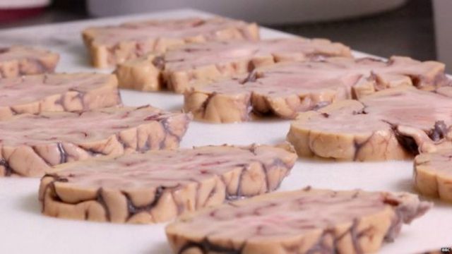 brain - фото 1