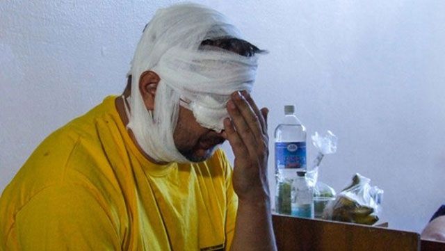 Під Донецьком поранили відомого російського пропагандиста