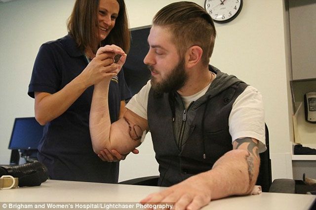 Чоловіку пересадили обидві руки після трагедії в Афганістані