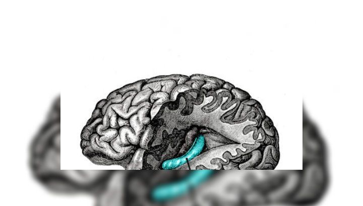 Каліфорнійські вчені винайшли протез пам'яті