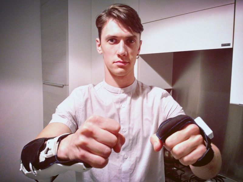 Українець створив пристрій, який змушує працювати паралізовану руку