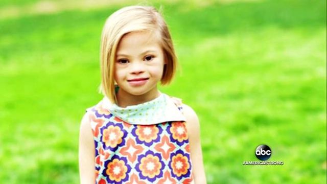 7-річна дівчинка з України з синдром Дауна зворушила світ