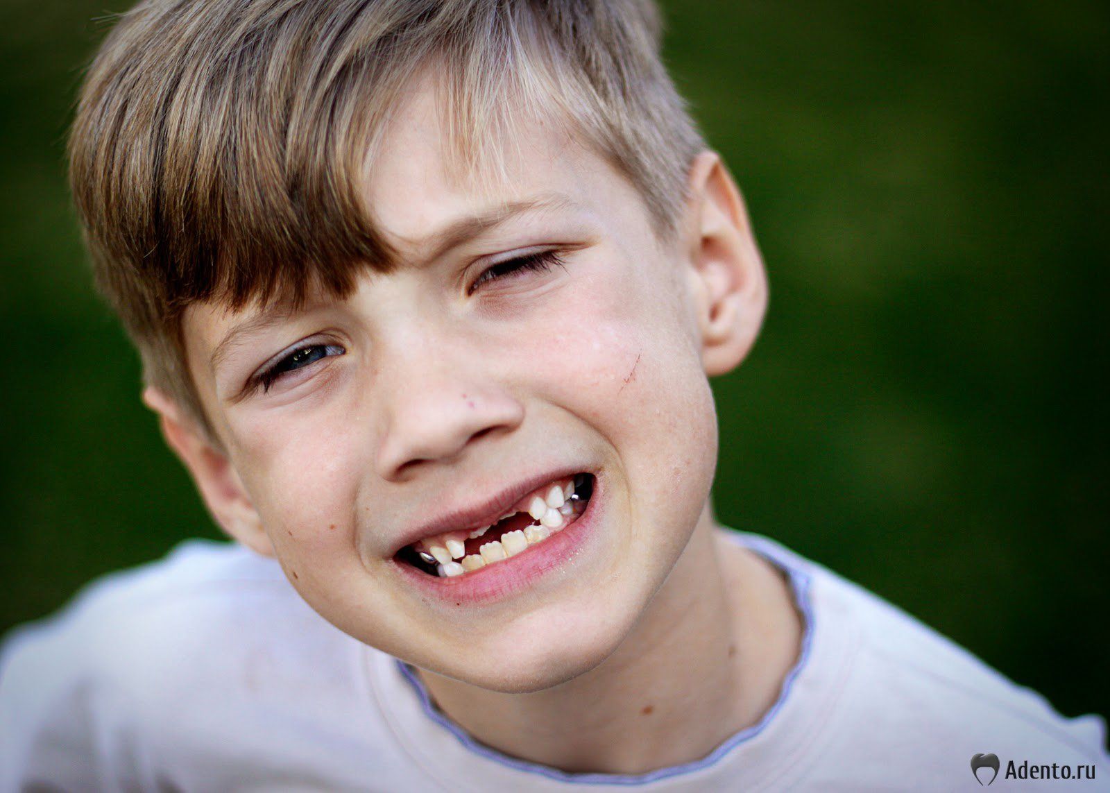 Стоматологи розповіли, який улюблений снек шкодить зубам