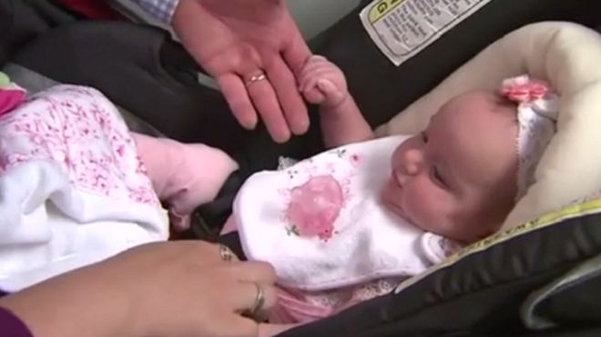 У штаті Техас дівчинка народилася двічі