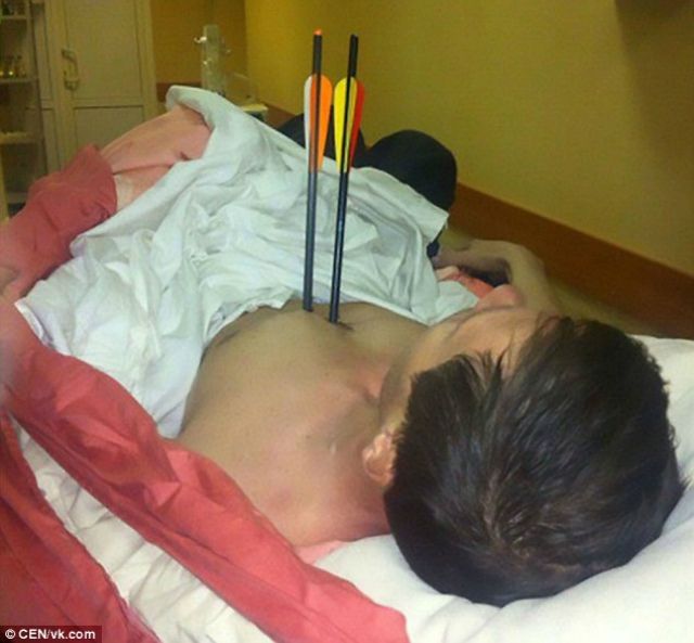 Мешканець Росії вижив, маючи дві стріли у серці