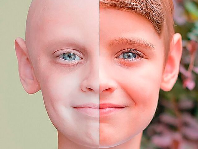 Медики розповіли, як знизити ризики розвитку раку