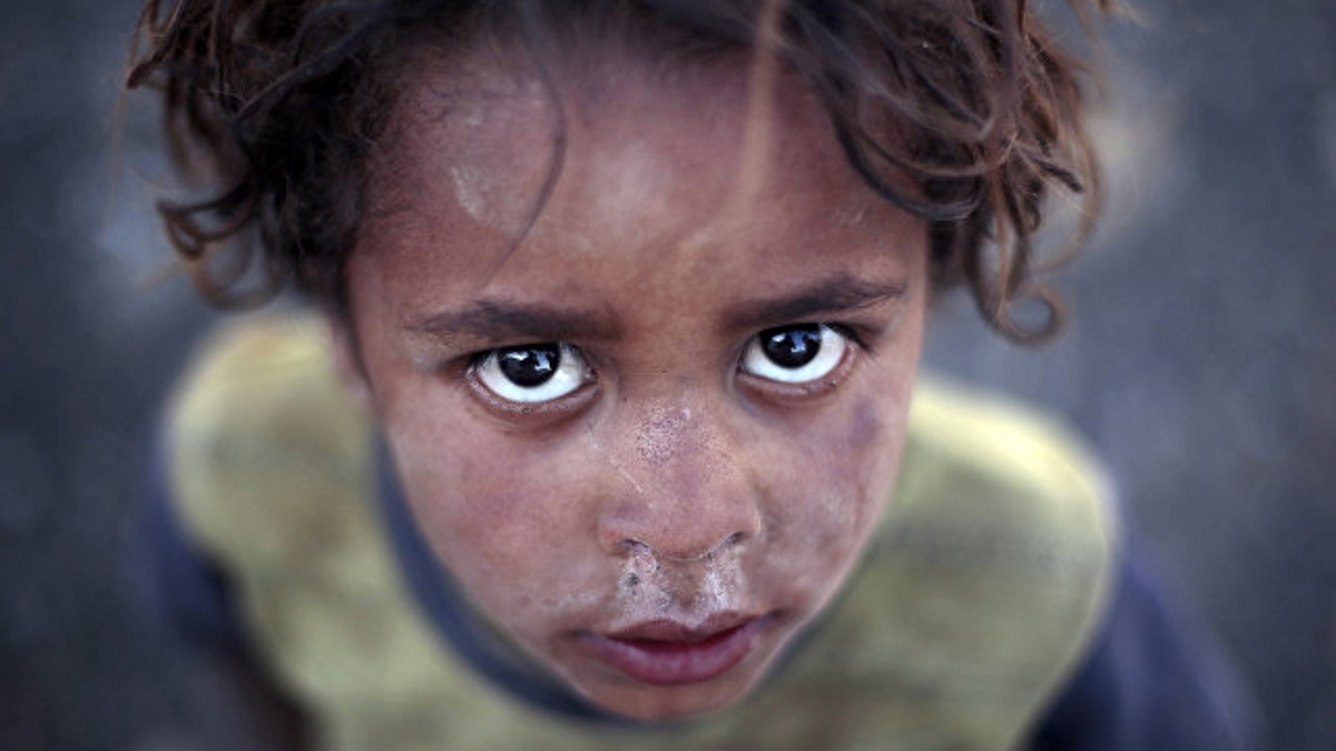 У Ємені зростає кількість хворих на холеру - фото 1