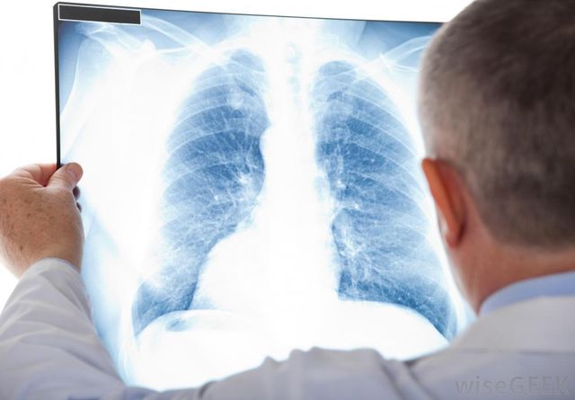 Втім, кава може викликати рак легенів - фото 117579