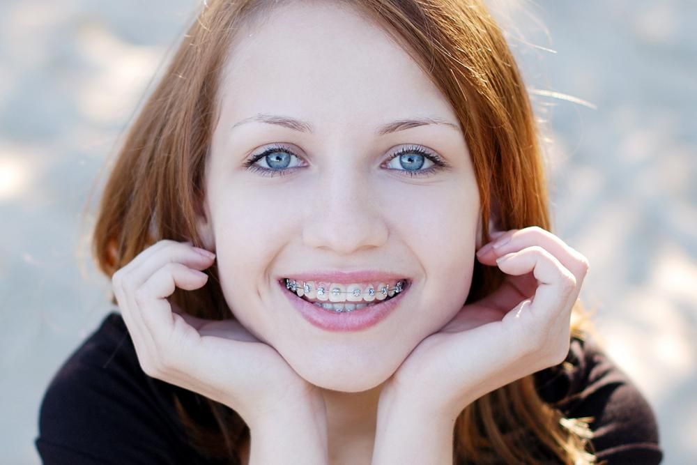 Експерт розповів, чим шкідливі брекети