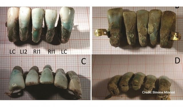 Археологи знайшли середньовічний зубний протез
 - фото 120656