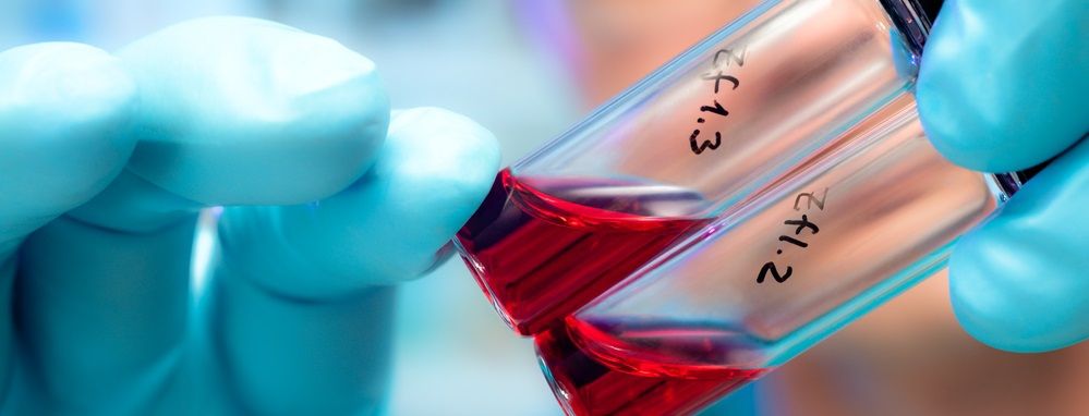 У Росії з'явився новий небезпечніший вірус ВІЛ