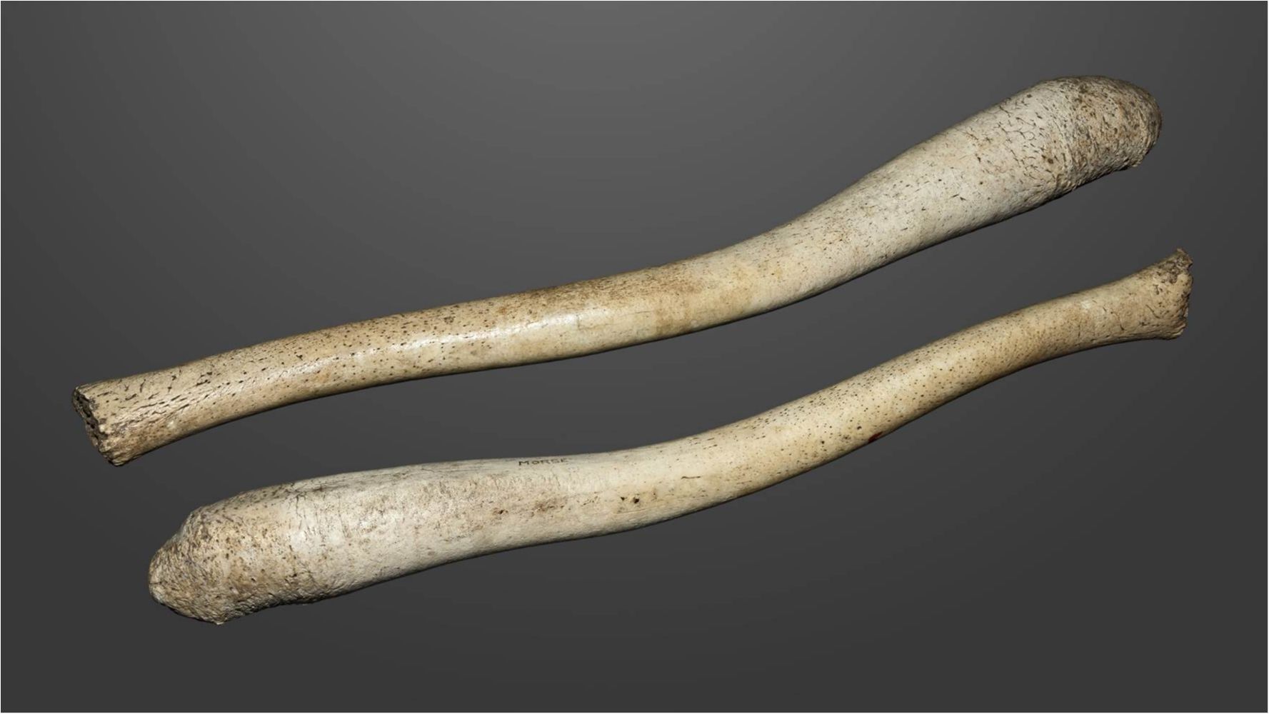 Учені дізналися, чому в чоловічому пенісі немає кістки