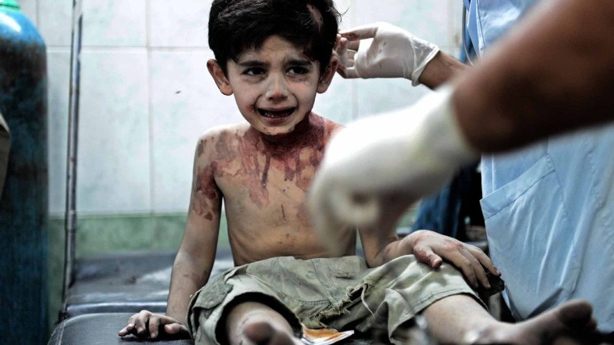 У Росії жорстоко прокоментував моторошні фото дітей у Сирії - фото 1