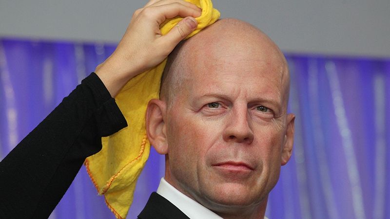 Вчені зробили несподіване відкриття про облисіння