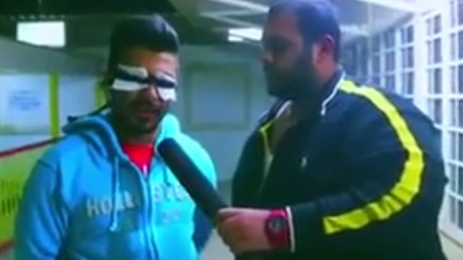 Ведучий у прямому ефірі підпалив свого гостя