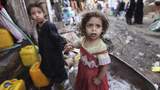 ООН назвала шокуючу цифру голодуючих дітей у Ємені