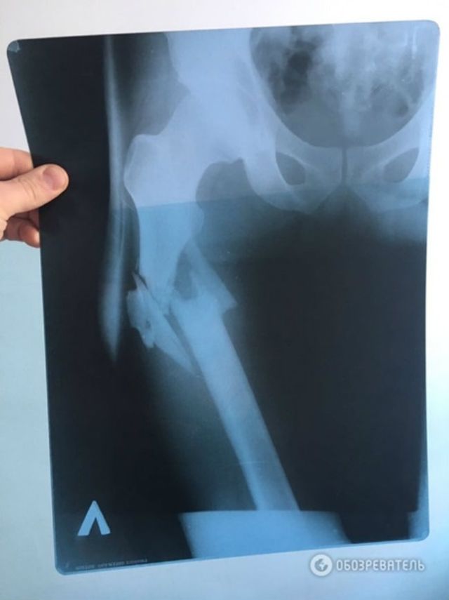 Пашинський збрехав у своїх свідченнях, – лікар
 - фото 131280