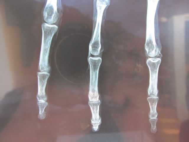 Рука - фото 131435