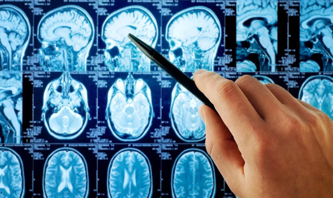 Пожертвуй мозок – допоможи науці