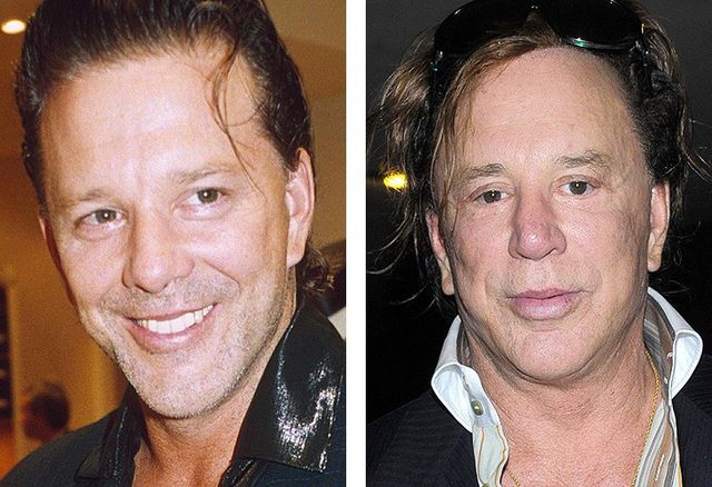 7 знаменитих красенів, які зробили пластику - фото 148565