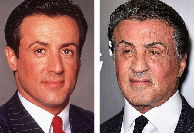 7 знаменитих красенів, які зробили пластику - фото 148569