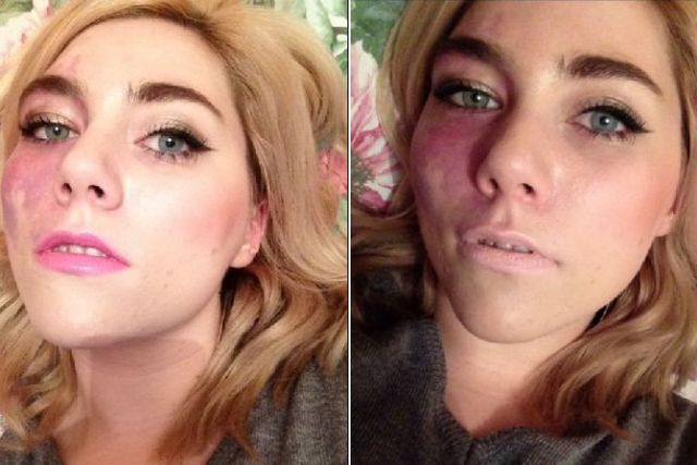 Вони вас вразять: 5 відомих дівчат з рідкісною зовнішністю - фото 149386