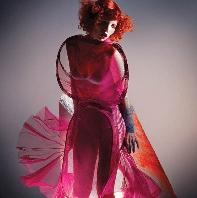 Геть стереотипи! Дівчина із моторошною патологією стала супермоделлю - фото 151813