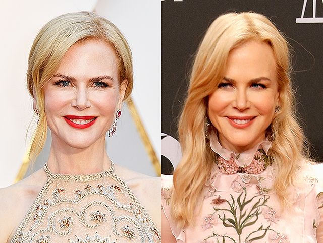 Що з Кідман? Пластичний хірург прокоментував дивні зміни актриси - фото 151482