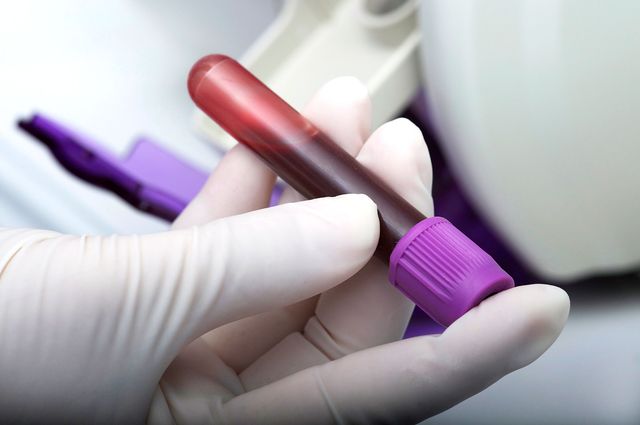 Відчуваєте втому щодня? У вас може бути серйозна хвороба - фото 149466