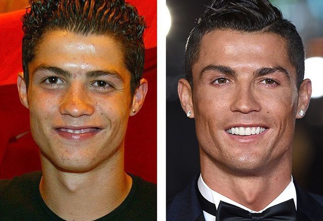 7 знаменитих красенів, які зробили пластику - фото 148568