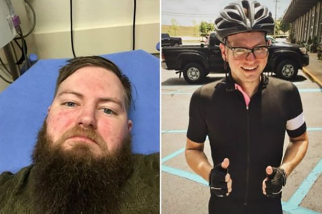 Неймовірні перевтілення людей, які перестають вживати алкоголь - фото 150288