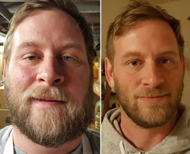 Неймовірні перевтілення людей, які перестають вживати алкоголь - фото 150289