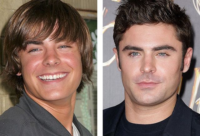 7 знаменитих красенів, які зробили пластику - фото 148566