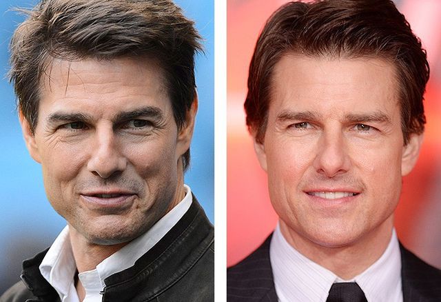 7 знаменитих красенів, які зробили пластику - фото 148567