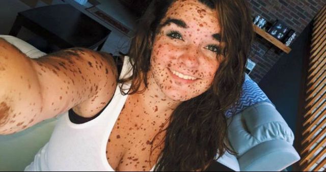 Вони вас вразять: 5 відомих дівчат з рідкісною зовнішністю - фото 149388