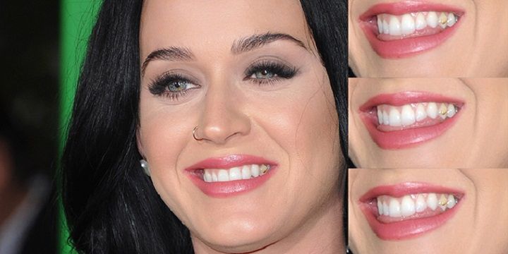 Прямісінько з 90-х: у моду повернулися "аксесуари" для зубів