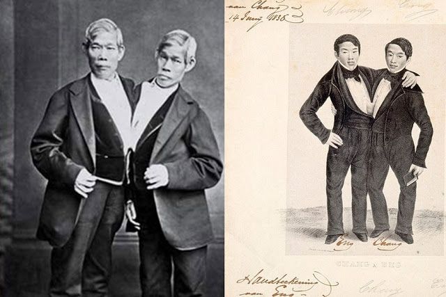 Сироти на шкірі! Як виглядали дивовижні персонажі "цирку потвор" - фото 159065