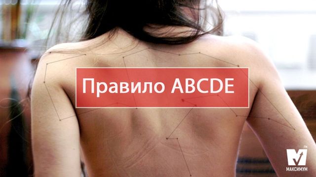 Прихована загроза: як перевіряти родимки і чи потрібно їх видаляти - фото 157628