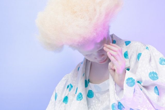 Унікальна особливість зовнішності цих близнят підкорила світ: вражаючі фото - фото 157156