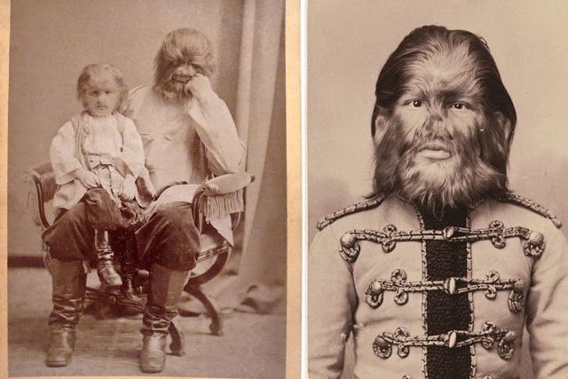 Сироти на шкірі! Як виглядали дивовижні персонажі "цирку потвор" - фото 159066