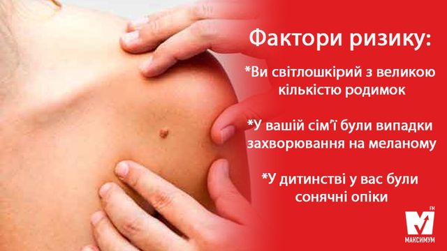 Прихована загроза: як перевіряти родимки і чи потрібно їх видаляти - фото 157627