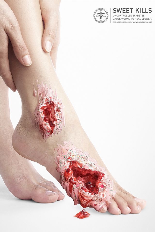 Що відбувається з тілом під впливом цукру: шокуючі зображення - фото 159280